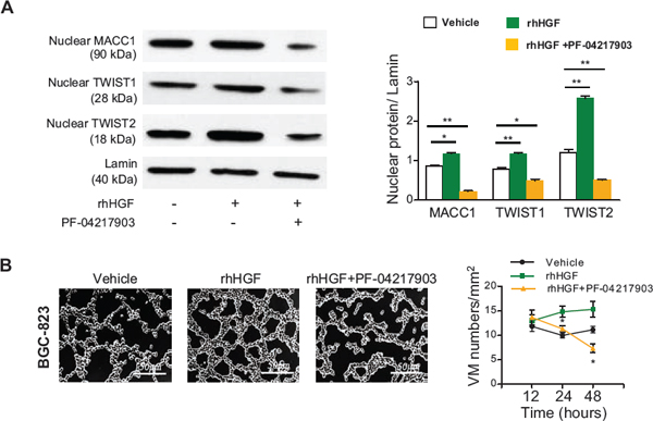 HGF/c-Met contributes to MACC1-induced VM in BGC-823 cells.