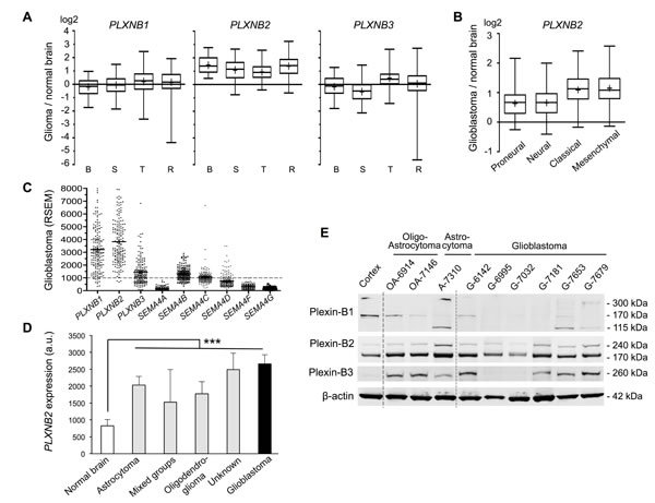 Plexin-B2 is upregulated in glioma.