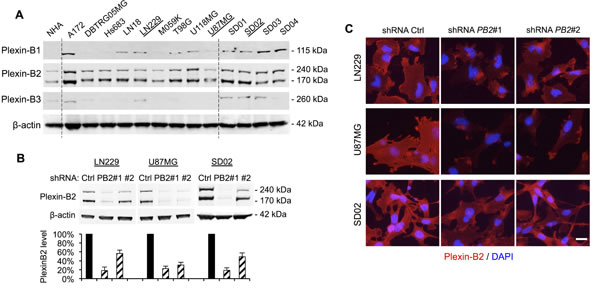 Plexin-B2 expression in glioma cell lines and shRNA knockdown.