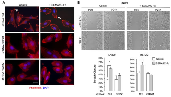 Plexin-B2 activation induces cytoskeletal dynamics in glioma cells.