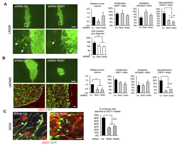 Invasive glioma growth is diminished by Plexin-B2 knockdown.