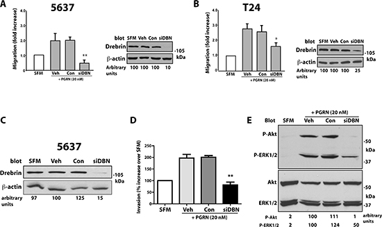 Drebrin modulates progranulin-induced motility and signaling of urothelial cancer cells.