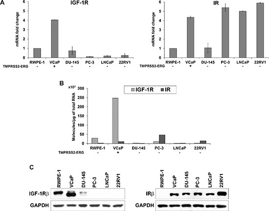 Evaluation of IGF-1R and IR basal expression in prostate cell lines.