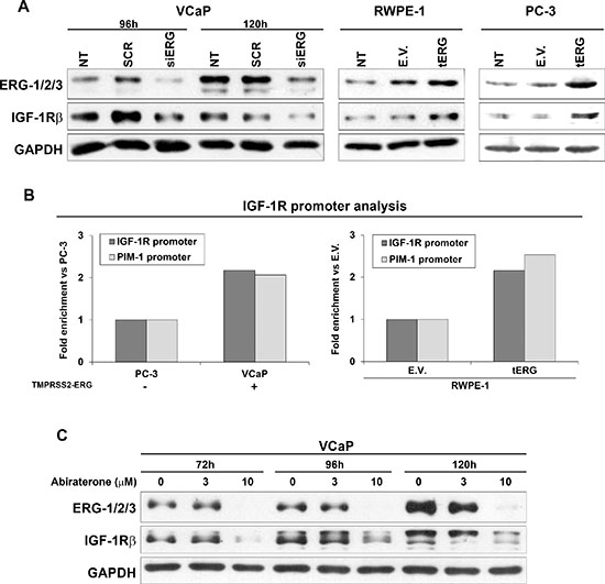 tERG-dependent IGF-1R induction in prostate cancer cells.