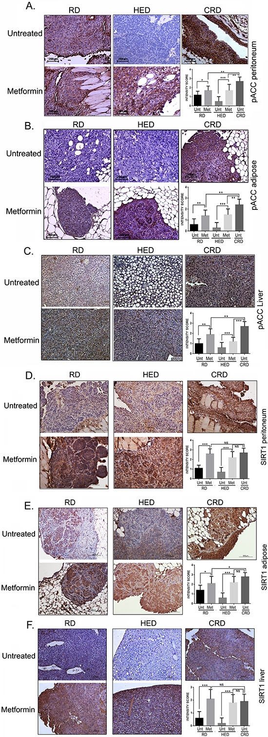 Metformin (Met) induced AMPK and SIRT1.