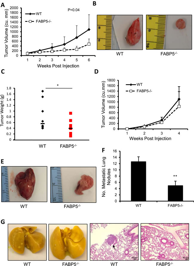 Host FABP5 modulates primary tumor growth and metastasis.