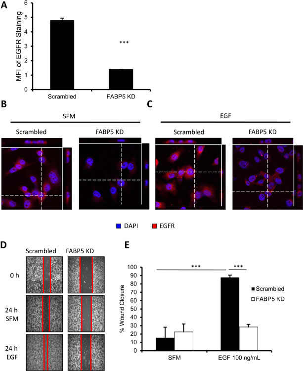 FABP5 mediates metastatic function of TNBC cell line through EGFR.