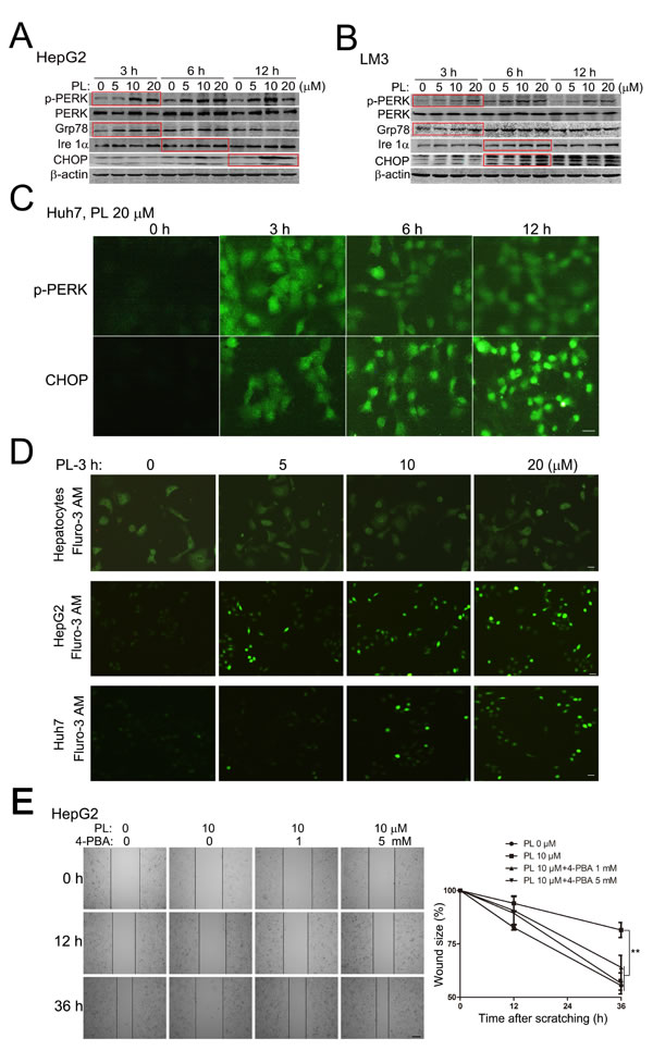 Piperlongumine induced ER stress-responses to suppress HCC cell migration preferentially.