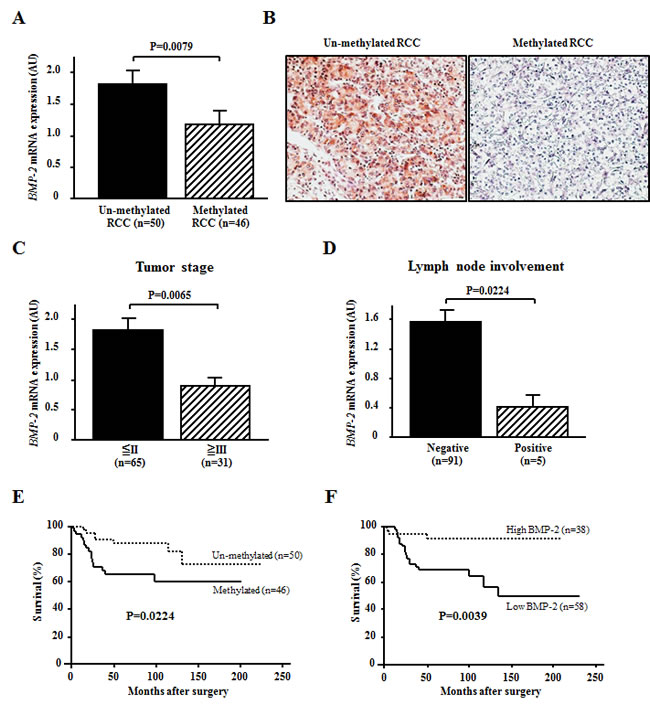 Effects of BMP-2 methylation status on the expression level of BMP-2 mRNA and association with clinicopathological findings.