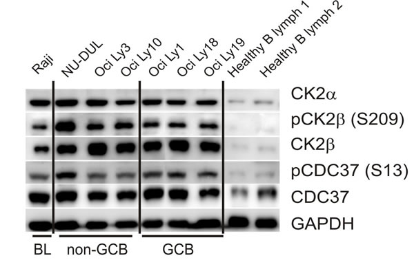 WB assays for CK2 expression in lymphoma cell-lines and normal B-cells.