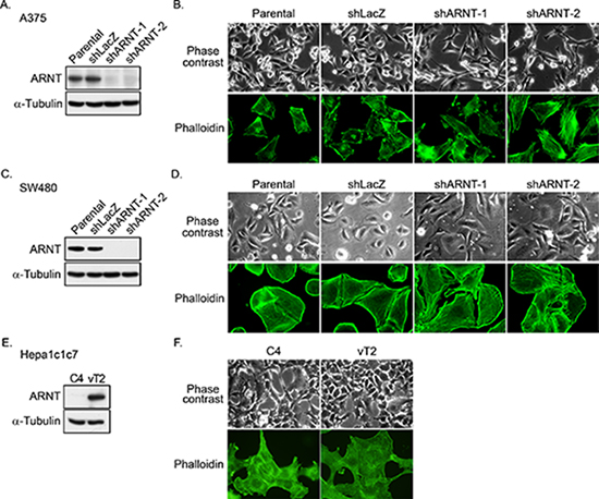 ARNT silencing promotes morphological changes in tumor cells.