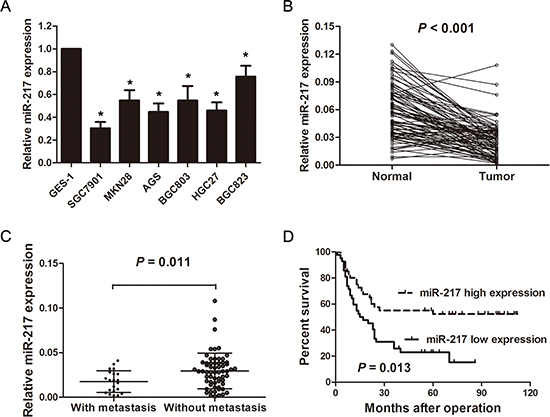 miR-217 is significantly down-regulated in gastric cancer cell lines and tissues.