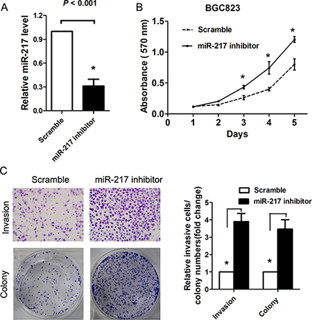 Blocking of endogenous miR-217 promotes gastric cancer proliferation and invasion.