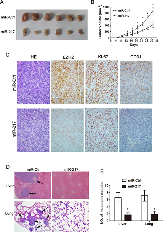 Ectopic miR-217 expression inhibits tumor growth and metastasis in vivo.
