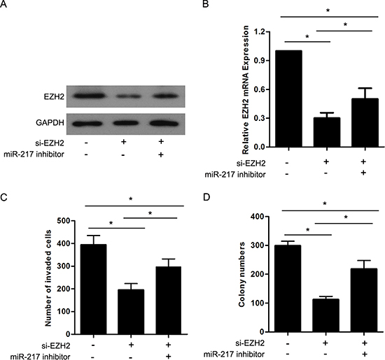 EZH2 is involved in miR-217 mediated cell proliferation and invasion in gastric cancer.