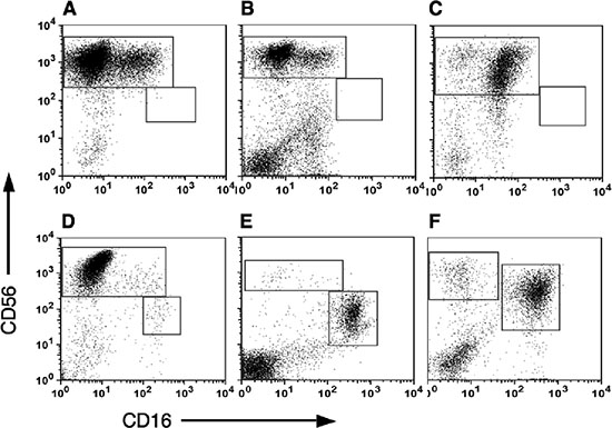 Subset analysis of NK cells in Tumor infiltrating lymphocytes (TILS).