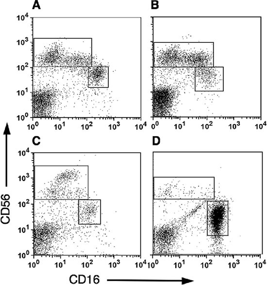 CD56bright CD16dim natural killers cells are highly enriched within pleural and peritoneal fluids from cancer patients.