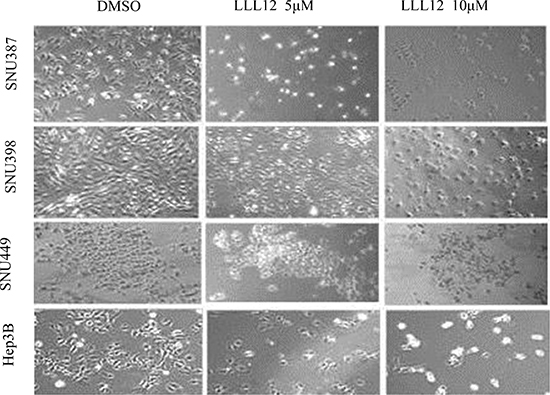 Morphologic features of LLL12-induced cell death in HCC cell lines.