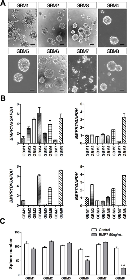 BMP7 decreases sphere formation in primary GBM-TIC cultures expressing BMPR1B.