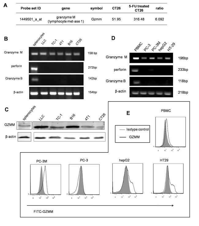 GZMM is expressed in murine and human malignant cell lines.