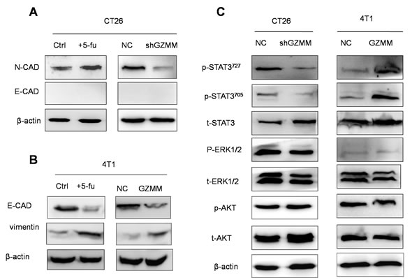 GZMM is associated with the epithelial-mesenchymal transition of cancer cells, and STAT3 signaling pathway activation is involved in GZMM resulting in the EMT.