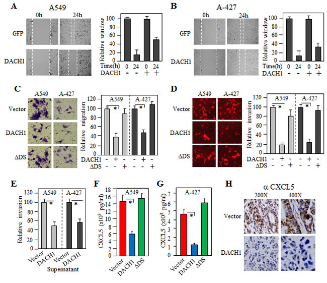DACH1 inhibited lung cancer cell migration, invasion and CXCL5 secretion.