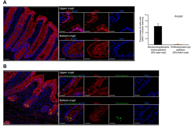 DKK-1 is present within the nucleus of differentiated human intestinal cells.