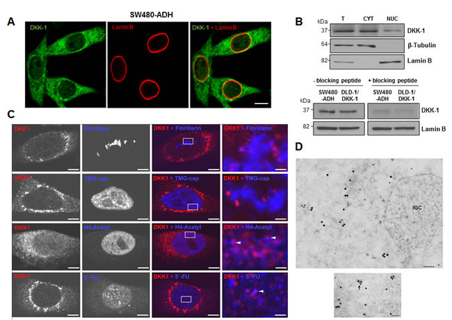 DKK-1 partially locates in the cell nucleus at sites of active transcription.