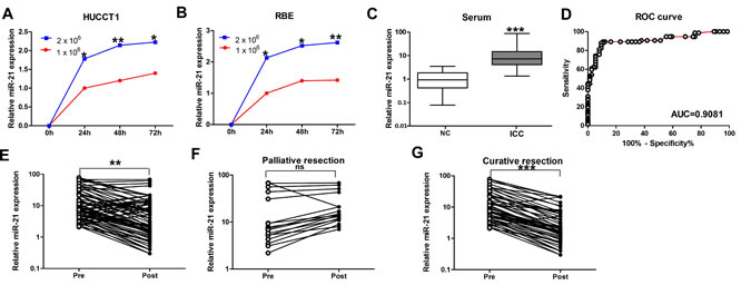 Expression of miR-21 in culture media of ICC cell lines and serum samples.