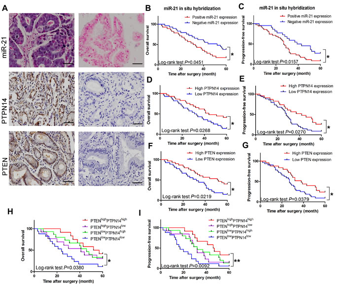 Clinical significance of miR-21,