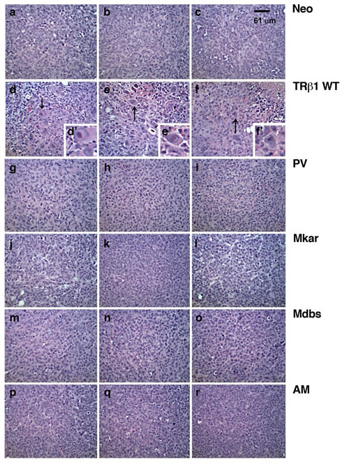 Comparison of histological characteristics in tumors derived from Neo cells, MDA-TR&#x3b2;1 and MDA-C-terminal mutants (PV, Mkar, Mdbs, and AM).