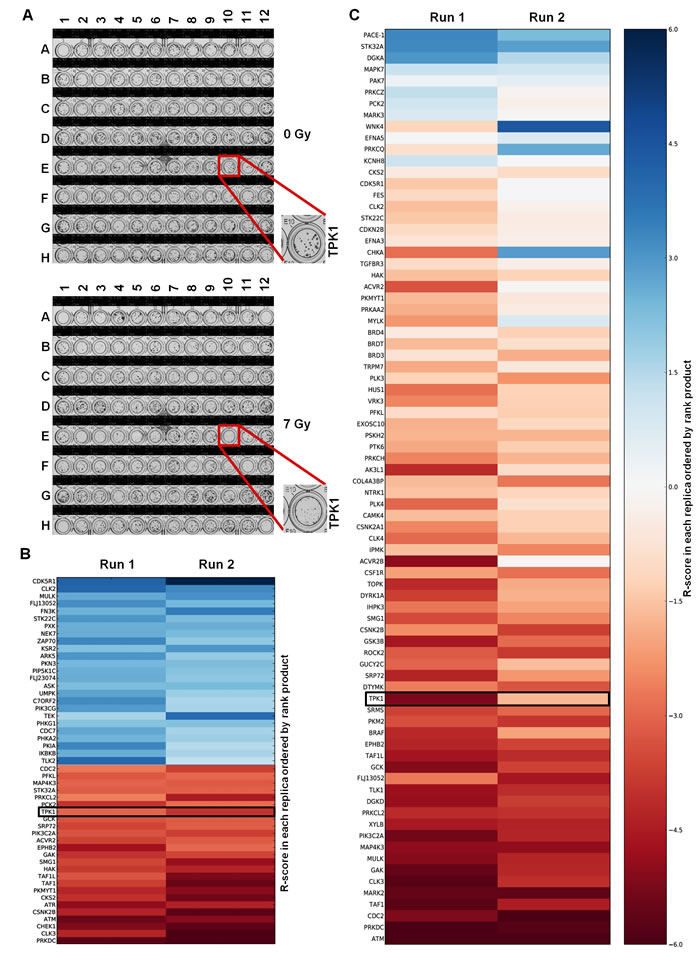 High-throughput colony formation screen identifies TPK1 as novel radiosensitizer.