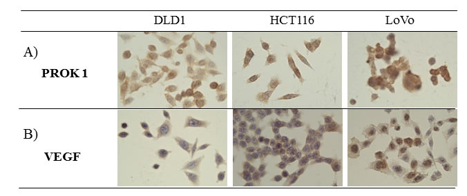 The expression of PROK1 and VEGF protein in colon cancer cell lines(DLD-1, HCT116, LoVo) by immunohistochemical staining with anti-PROK1 mAb.