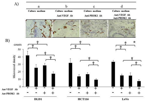 Investigation of CD31 immunohistochemical staining in mice in response to colorectal cancer cell fluid(colorectal cancer cell lines:DLD-1, HCT116, HT29).