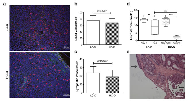 Diet-induced hypercholesterolemia is not associated with increased angiogenesis, lymphangiogenesis, and circulating testosterone levels.