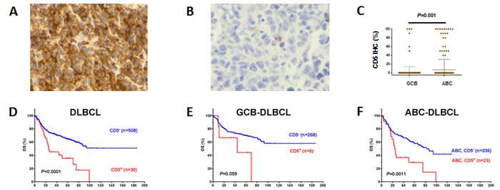 Expression and prognostic significance of CD5 in
