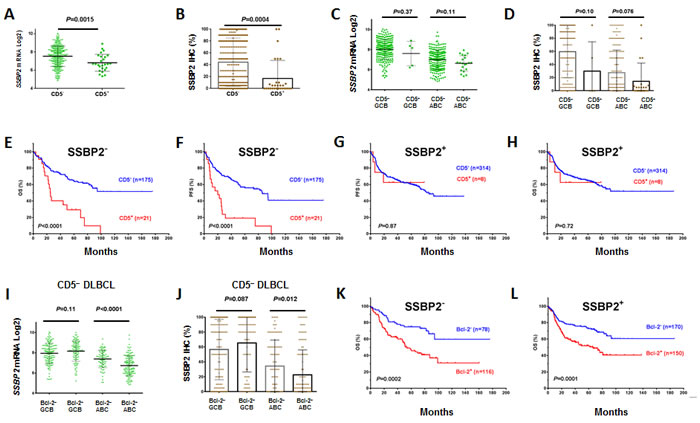 Correlation between CD5 and SSBP2 expression in DLBCL.