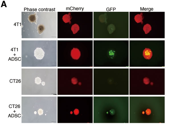 Enhanced tumor-initiating properties of breast and colon cancer cells by ADSC stimulation.