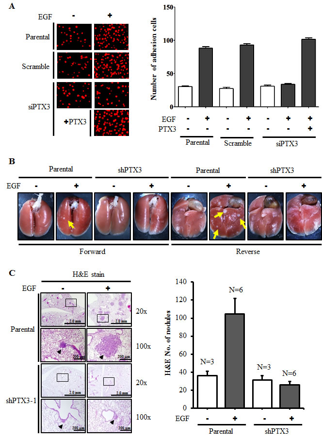 PTX3 mediates EGF priming for tumor dissemination to the lungs.