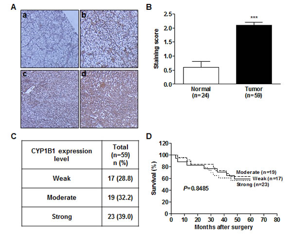 CYP1B1 protein is up-regulated in RCC tissues.