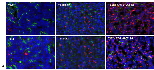 T cells infiltrated into tumors T1 and T2 in both models.