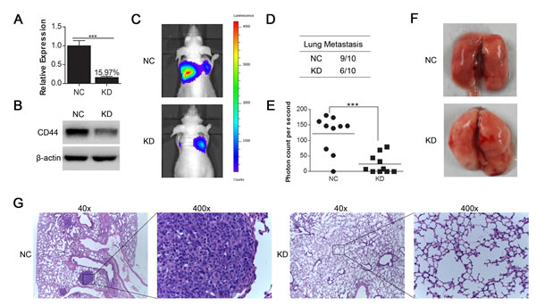 Fig.4: CD44 knockdown in luciferase-labeled MHCC97-H cells inhibited lung metastasis generated by tail vein injection in nude mice.