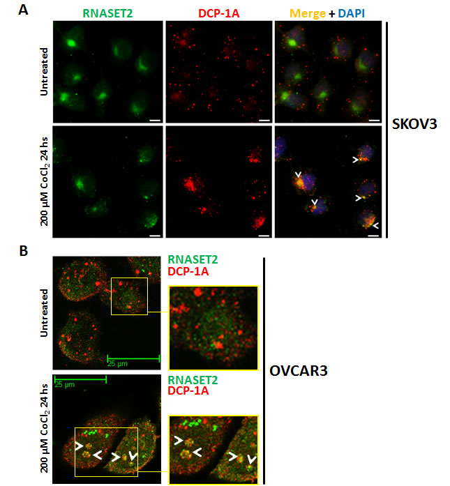 RNASET2 protein re-localizes to P-bodies in response to chemically-induced hypoxia.