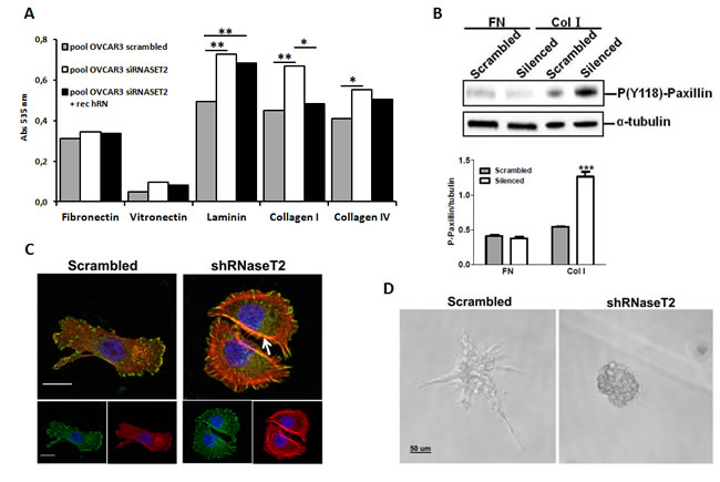 RNASET2 silencing affects both cell adhesion and FA dynamics in OVCAR3 cells.