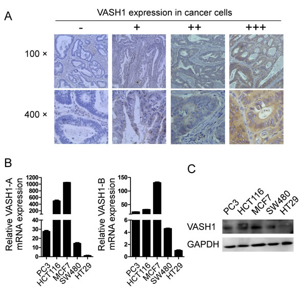 Expression of VASH1 in colon cancer cells.