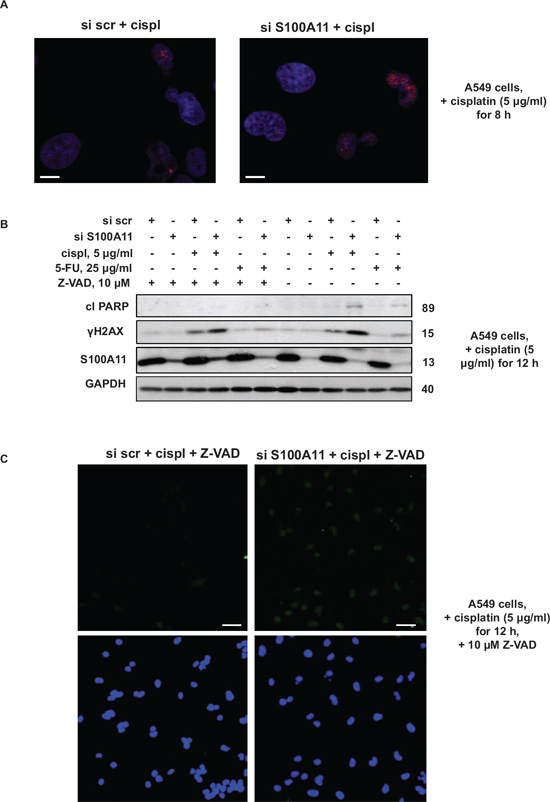 Silencing of S100A11 leads to increased formation of DNA strand breaks.