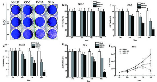 Cytopathic effects and cell death induced by MV-Edm.