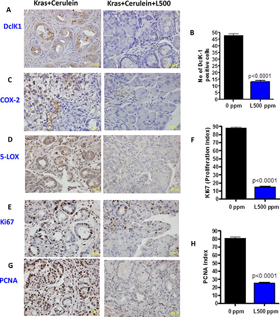 A&#x2013;H. Effect of licofelone on cerulean-induced pancreatitis on inflammation, proliferation and DclK1 expression.