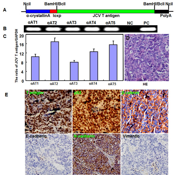 The spontaneous lens tumor of JCV T antigen transgenic mice by &#x3b1;-crystallin A promoter.