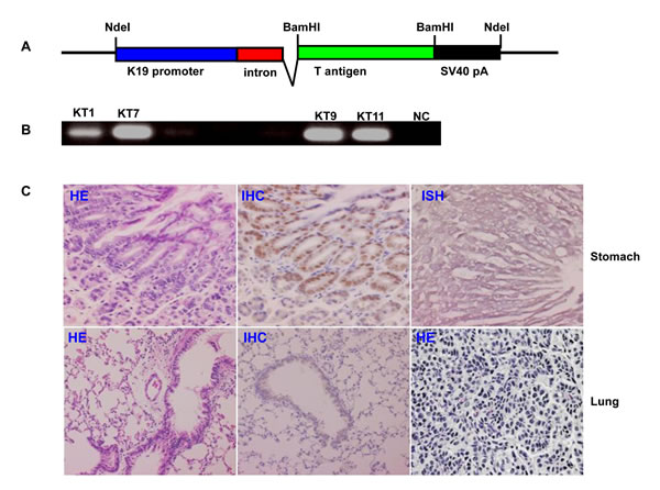 The JCV T antigen transgenic mice by cytokeratin 19 promoter.